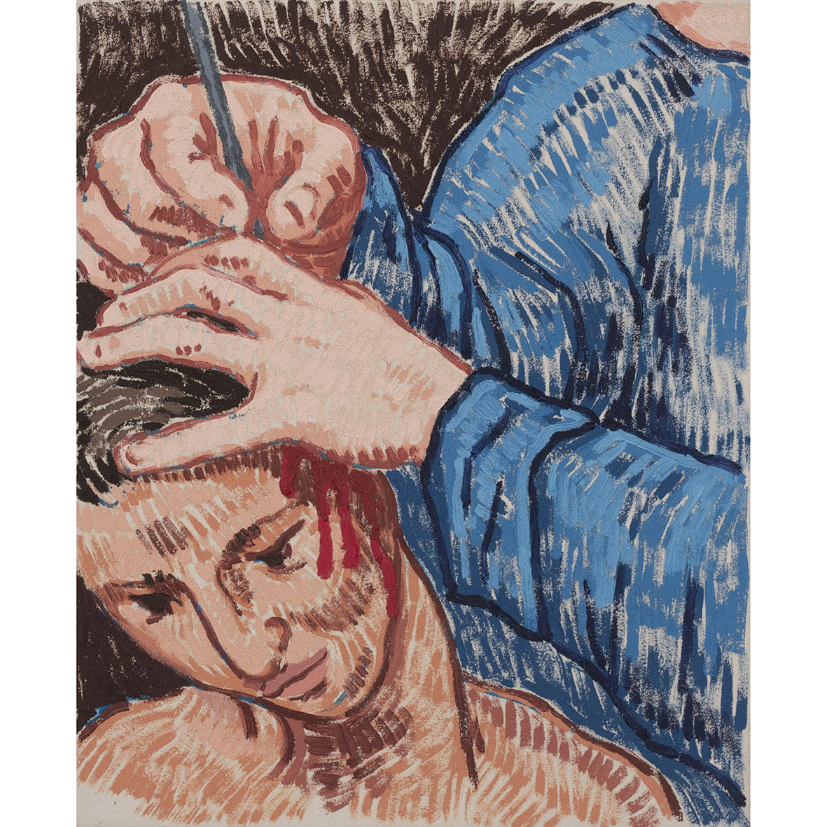 Erin Murphy | Painting | Elective Surgery (Trepanation)